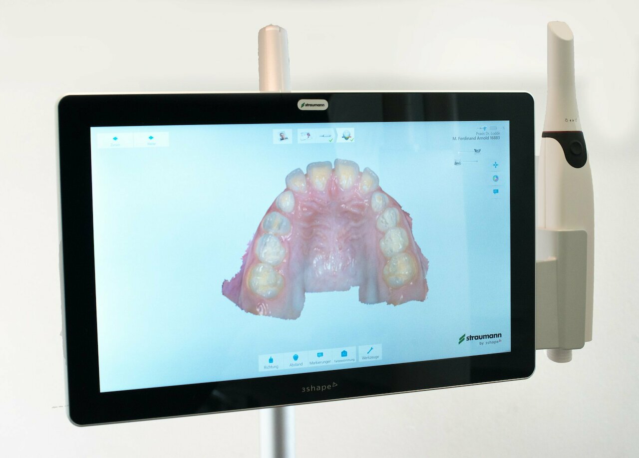 Digitaler Zahnabdruck mit 3D-Scanner
