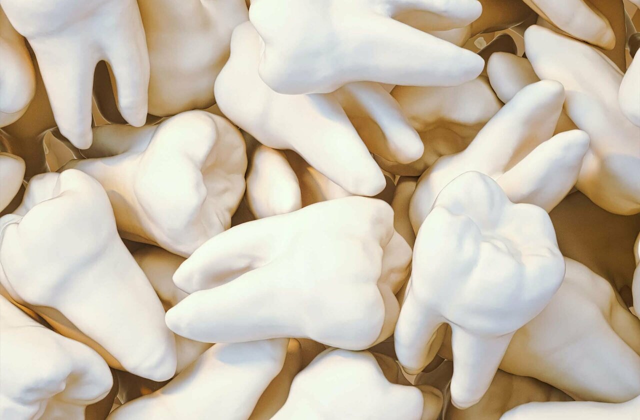 Weisheitszähne ziehen: Ist das wirklich nötig? Image 1